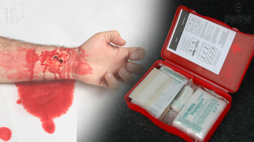 Sytuacja drogowa — pytanie 6646: Co należy zastosować do opatrzenia silnie krwawiącej rany?